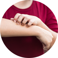 photo of woman scratching arm